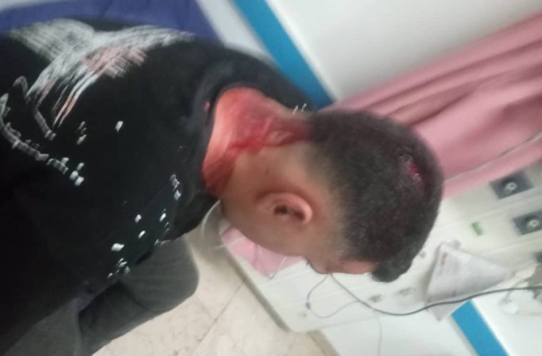حمله دستفروشان به مأموران اجرائیات شهرداری مسجدسلیمان / جراحت شدید یکی از کارکنان در حین انجام مأموریت حمله دستفروشان به مأموران اجرائیات شهرداری مسجدسلیمان / جراحت شدید یکی از کارکنان در حین انجام مأموریت