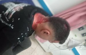 مصدومیت نیروی اجرایی شهرداری مسجدسلیمان در عملیات جمع آوری سد معبر+تصاویر مصدومیت نیروی اجرایی شهرداری مسجدسلیمان در عملیات جمع آوری سد معبر+تصاویر